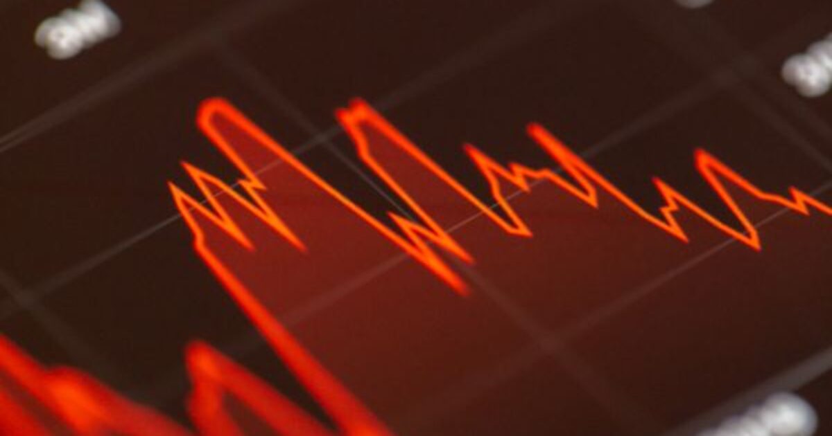 gráfico de dólares americanos | leilões de linha | BC Anuncia Leilões de Linha para Segunda-feira com Valor Total de até US$ 1 Bi
